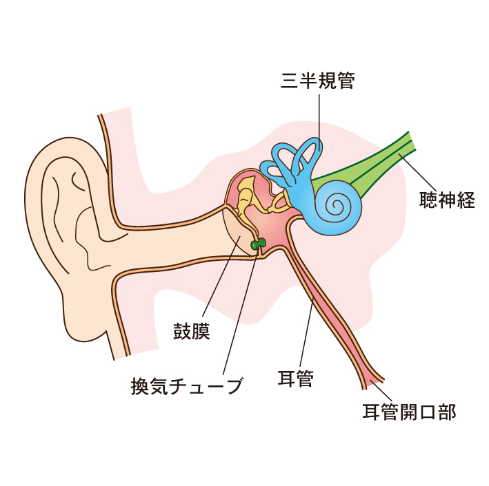 鼓膜 へこむ