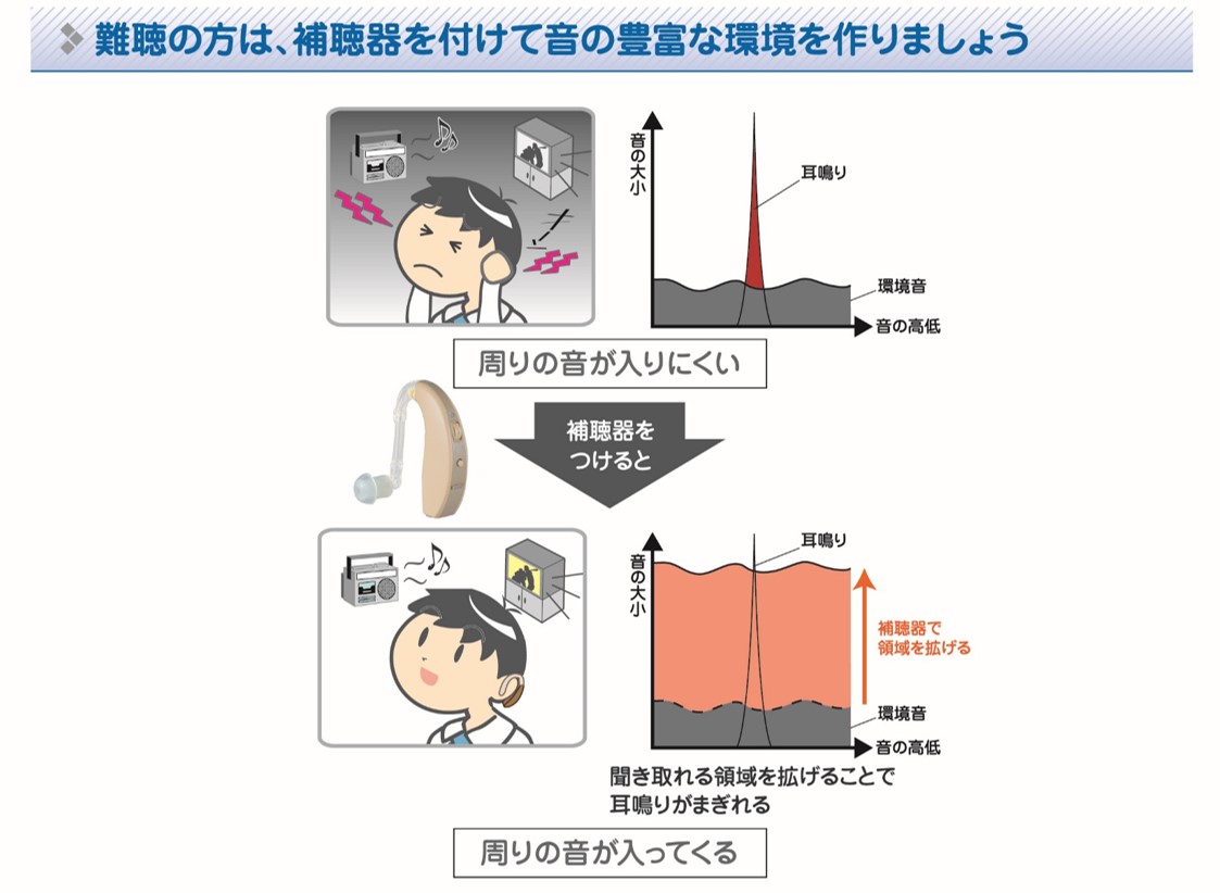 専門医 耳鳴り